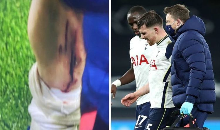 Hojbjerg responds to a horror tackle: I'm a Viking and I'm fine, but you owe me new shinpads
